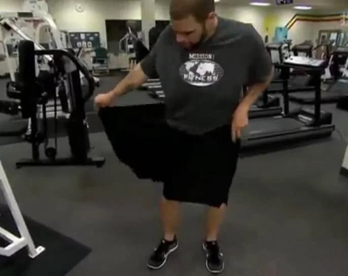 体重600多斤的小伙，疯狂减掉400斤，结果皮肤竟变成了这样！