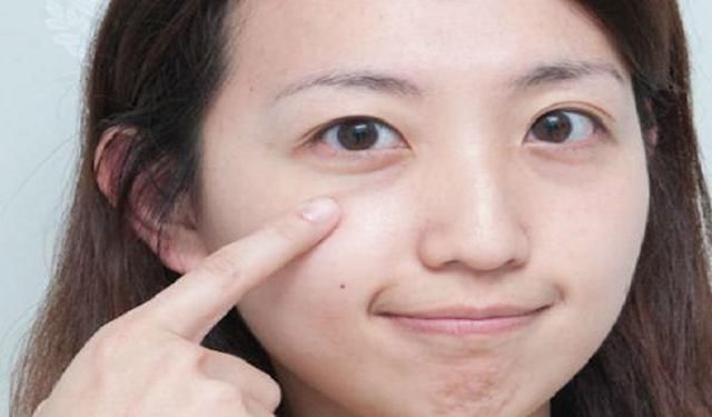 有一种神奇医用眼膏，120秒消眼袋，效果不输玻尿酸