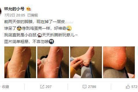 林允回应“撕脚皮”又怼网友?真性情到底是不是明星挡箭牌?