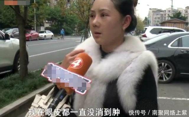 『漂亮』女子花9万元整容, 却脸肿脸烫的受不了, 如今完全像50岁大妈