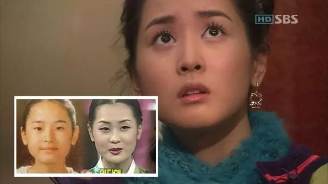 谁说整容太多脸会崩？这些明星用实力给大家辟谣！