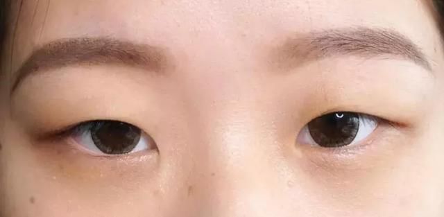 发际线男孩花2500修的眉毛这个鸟样