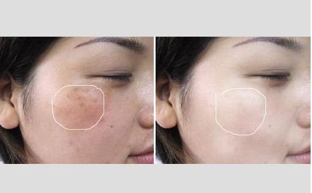 93岁姥姥说,药店这些不起眼的药膏,睡前一抹,皱纹全消失不见