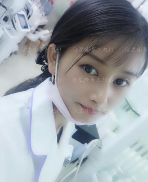 术后■鼻头肥大、山根低、没鼻梁，肋软骨隆鼻后变化有多大？