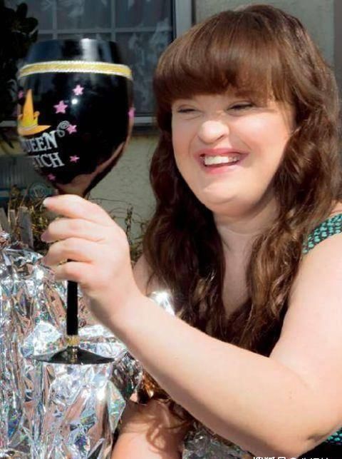 「发育不良」3张 患有残废的大牌明星，史泰龙神经损伤成面瘫，彼得丁克拉格发育不良