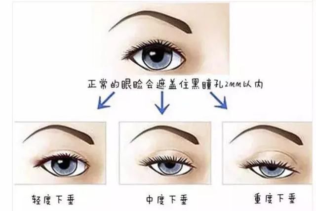 抖音眼:同样是眼睛,拯救全脸和祸害颜值的眼睛区别还真大