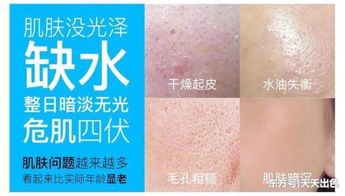 皮肤干燥起皮、毛孔粗大，出油长痘？做好这一步，肌肤水嫩又白皙