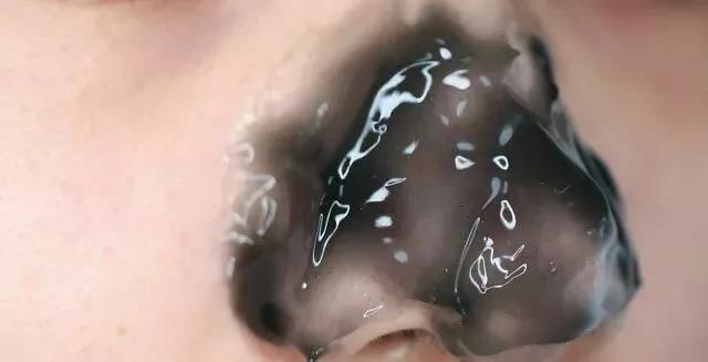 黑头粉刺+毛孔粗大?这份良心祛黑头指南收好了!