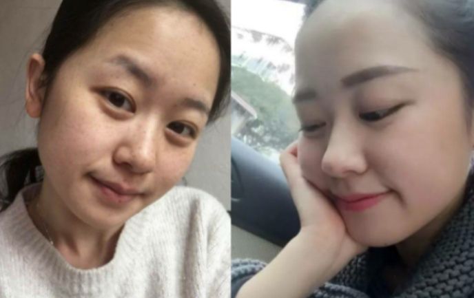 祛斑强过激光，美白堪比整形，只需睡前涂一涂，一夜变16岁少女肌