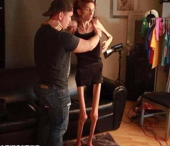 国外一女子从120斤瘦到了30斤，真的是瘦成了一道闪电