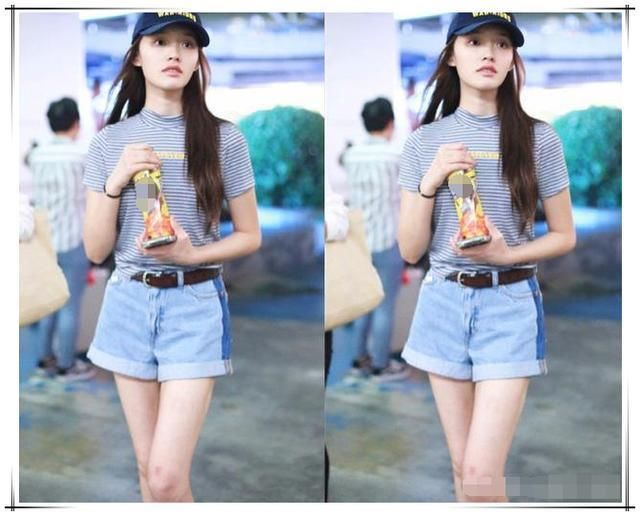 林允太奇葩了，满腿都是小疙瘩还敢穿短裤，网友:到底怎么想的?