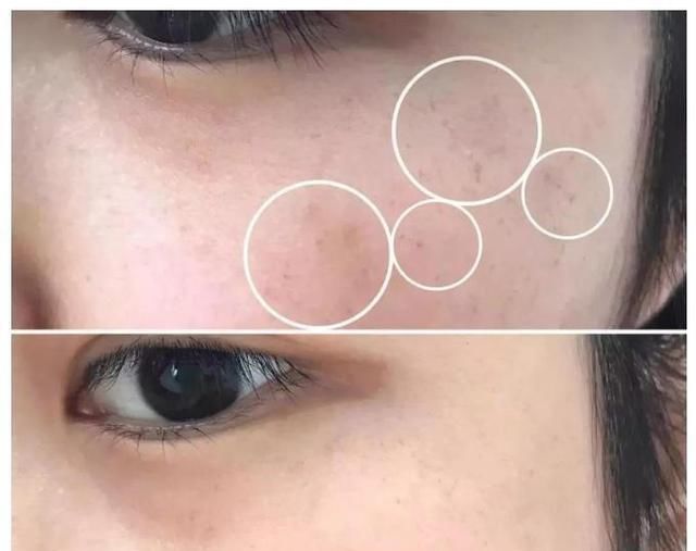  #毛孔粗大#是不是30岁之后,女人的皮肤就开始走下坡路了?