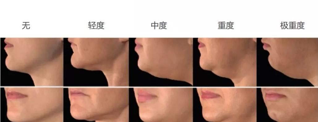  [外侧脂肪]脸上有这5个“迹象”的女人，容易显老，出现一个就要警惕