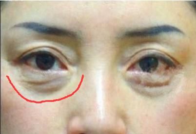 48岁小姨子偷偷说，药店一白菜价药膏，抹一点，色斑、皱纹全消