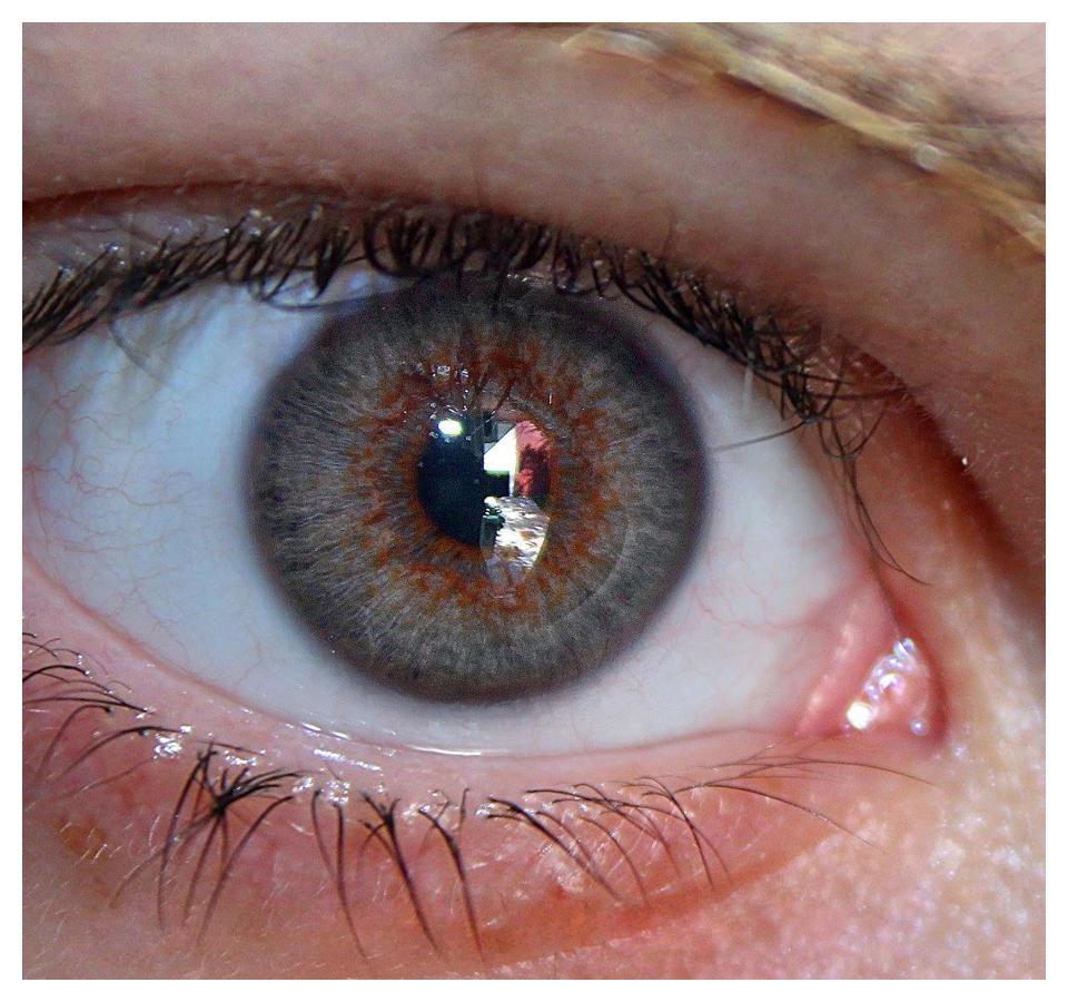 嫌人类丑，男孩花巨款将自己整形成了精灵，是绝美还是惊悚