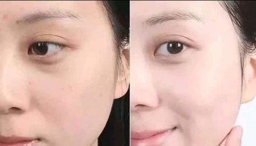 『偶尔』“肌断食”是什么意思?偶尔不涂护肤品,皮肤真的会变好吗?