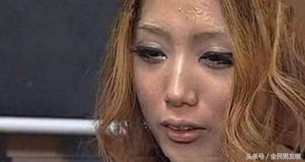 女子卸妆嫌麻烦，两年不卸妆医生给卸妆后吓懵了