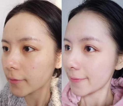 蜂蜜加白醋,睡前仅需敷一敷,护肤效果还不错