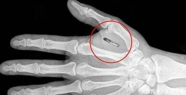 马云再次预言,手机即将消失,但是可能要给手掌