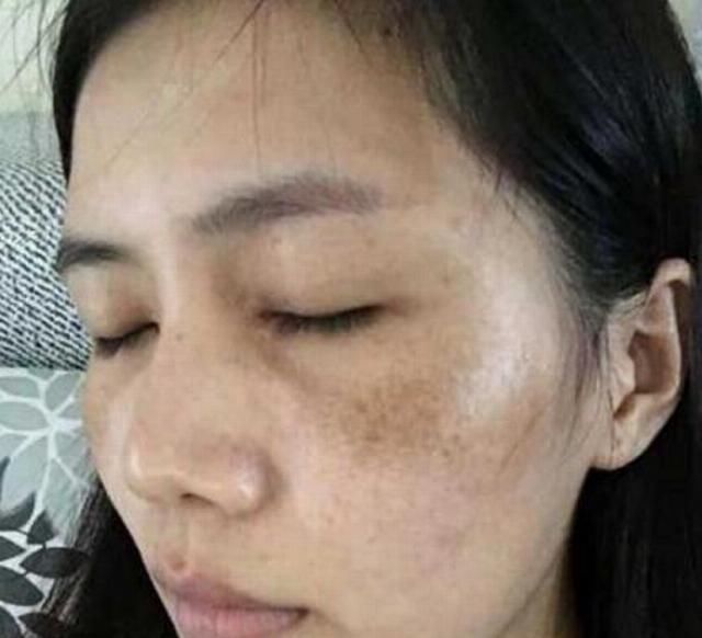  洗米水：皮肤差的妹纸，用洗米水加它敷面，十几天淡化老年斑
