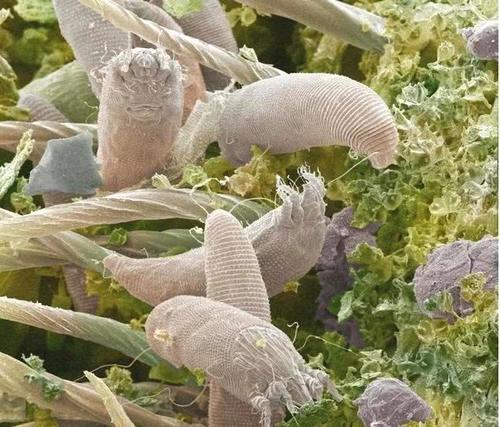 皮肤长满了痘痘粉刺?是螨虫在作怪,该怎么排出来?懊悔知道的太晚