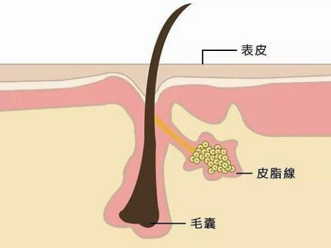  改善|头发油腻可能和频繁洗头有关，3个习惯常坚持，改善头发出油