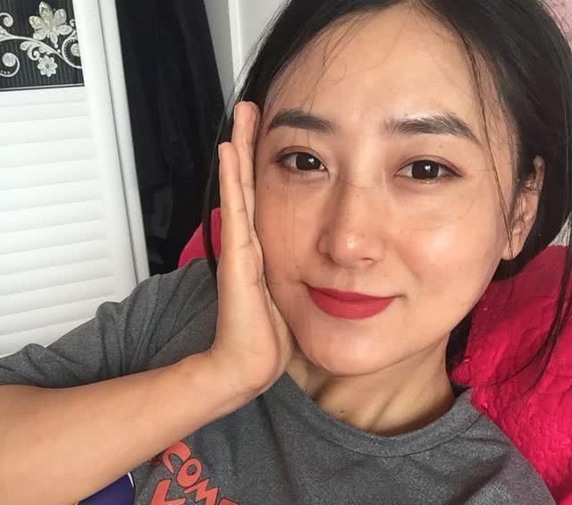 【调整】女生整容会被嫌弃吗只要没有这几点,整过之后还是很漂亮