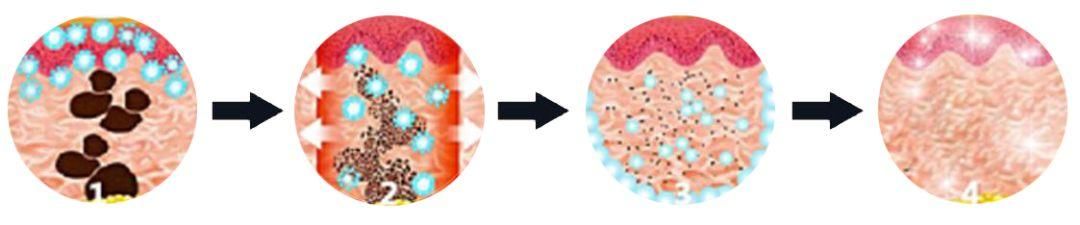 每个女人都希望青春永驻