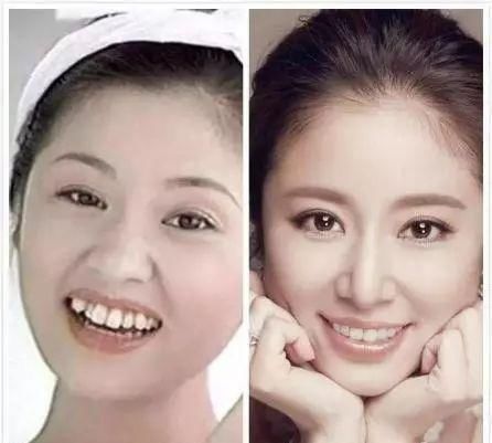  牙医■对不起，这则口红广告实在是让牙医们坐不住了！