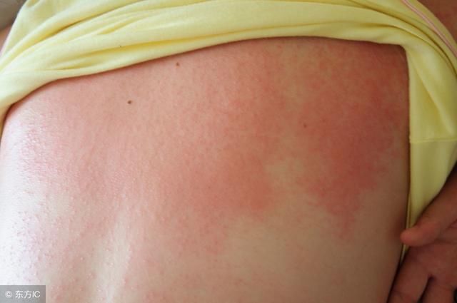 这5个防晒误区，几乎人人中招！难怪你会被晒黑晒伤！