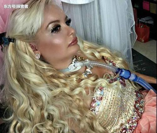 她9岁就瘫痪，但每天仍要打扮成芭比娃娃鼓励自己！