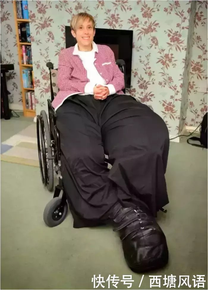 全球6个“十分特别”的女人: 有人像芭比娃娃, 有人胖到走不动路!