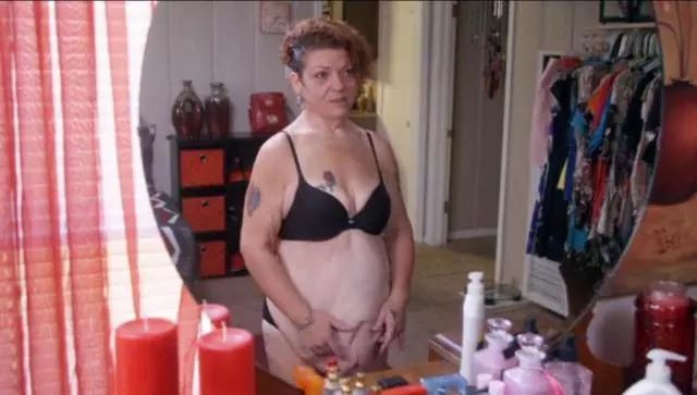 国外辣妈产后体重暴涨,疯狂减肥200斤,撩起衣服后尴尬了