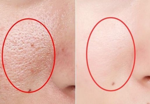 皮肤科教授透露:药店便宜乳膏”每晚抹点,皱纹斑点到老也找不到