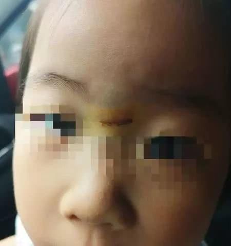 网曝:盐城某“国际幼儿园”老师踢伤孩子面部……家长怒怼求说法