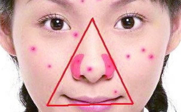 超级细菌!浙江一15岁男孩手贱挤了个痘子,不幸