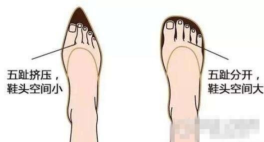 女孩看进来！这4类鞋别穿了 第2种比高跟鞋还伤脚
