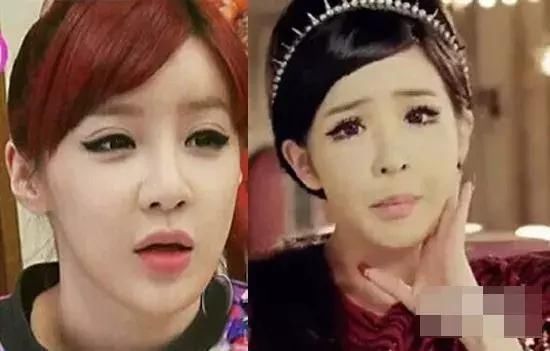 谁说整容太多脸会崩？这些明星用实力给大家辟谣！