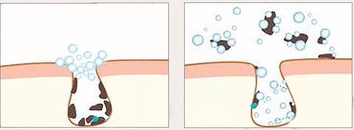 用它洗脸，面膜钱都省了，越洗越白净，洗完就能素颜出门