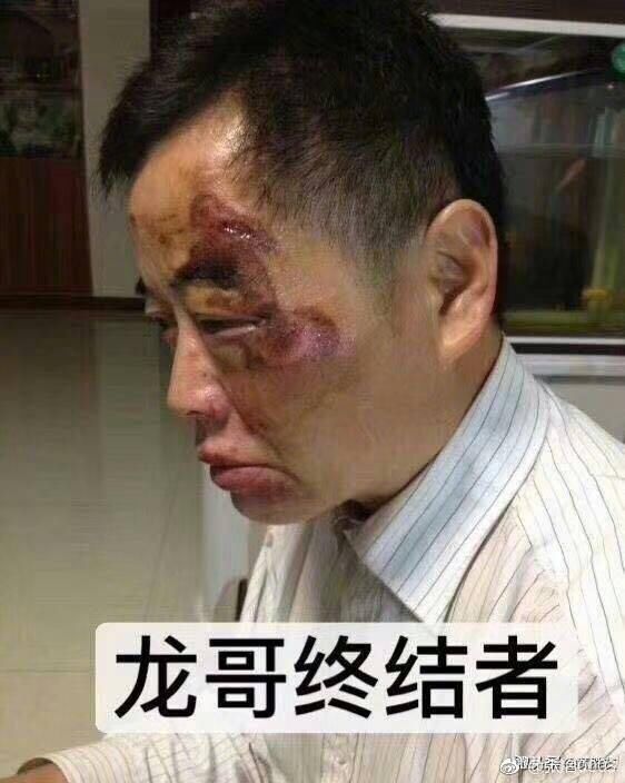 津云辟谣昆山“反杀”案持续发酵 网上这些话均为假，别信！