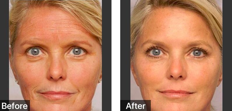 佟大为关悦“老夫老妻”霸屏综艺，演技开挂甜腻如初恋!