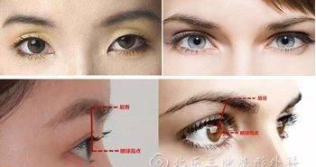  【玻尿酸】别再把眼窝凹陷当成欧式眼了！