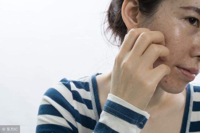 黄褐斑在脸上扎堆怎么办？用对这2招，轻松下斑脸蛋白净