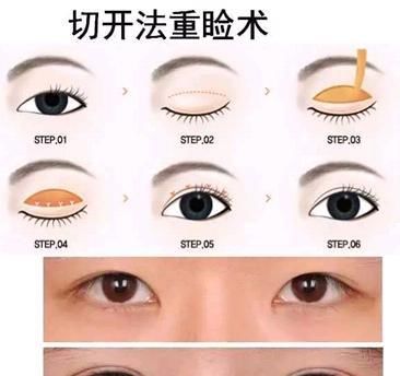 眼睛@怎样避免贴长期贴双眼皮的危害贴双眼皮