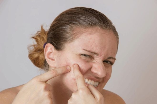 2种植物是“毛孔清道夫”, 坚持用半个月, 粗大毛孔, 痘痘不见了