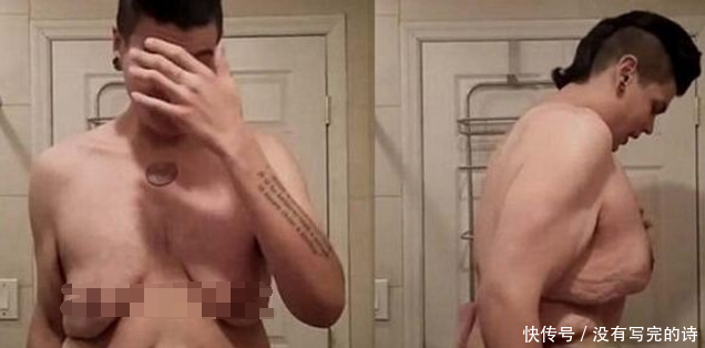 300斤小伙拼命减肥终于成功，而随后发生的事却让他更加烦恼