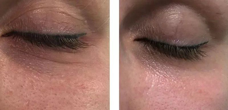 在闻风丧胆的“照妖镜”下同台battle，为什么高圆圆放肆大笑也不