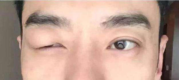 男星被蚊子咬后整个剧组停工, 耍大牌失误发文直呼蚊子可以改变世