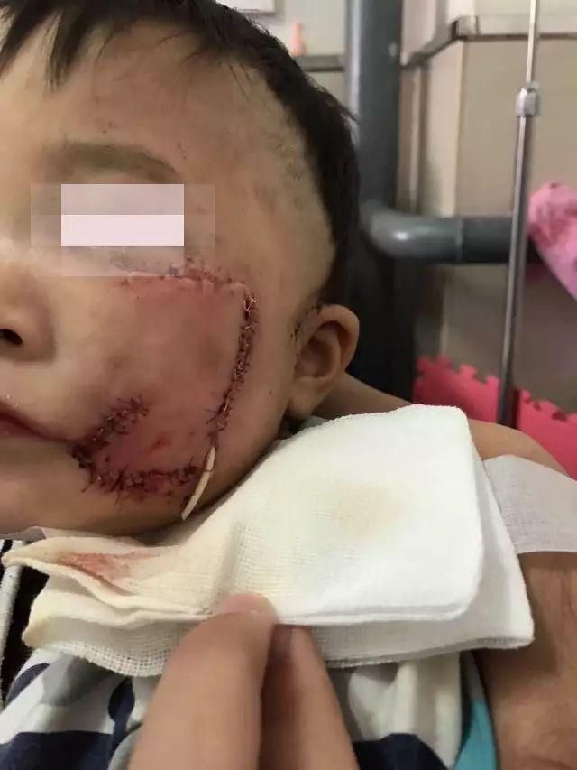 百万粉丝女网红遛狗不栓绳，还殴打8个月孕妇，真的好可怕!