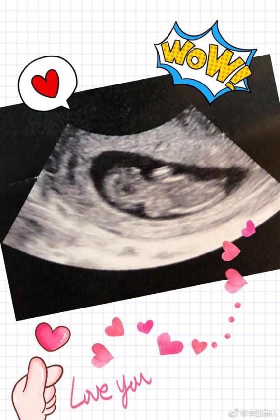 王祖蓝当爸 横店着火死2人 古巨基撒狗粮 赵薇状态超好